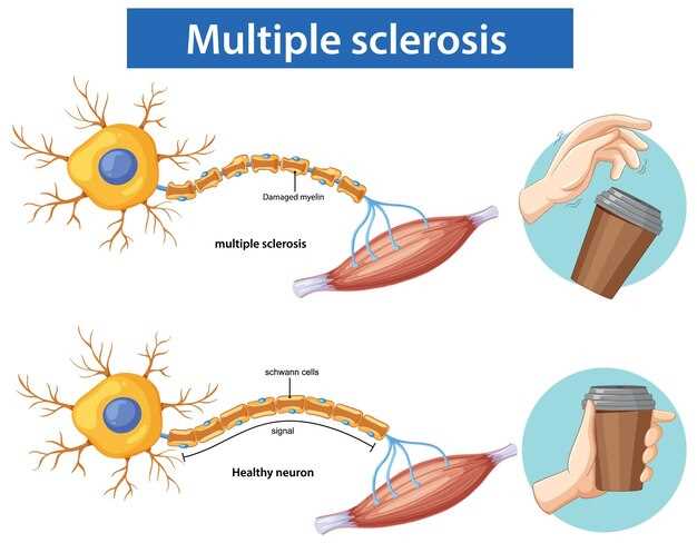Neurontin for RLS dosage effectiveness side effects and real patient experience guide