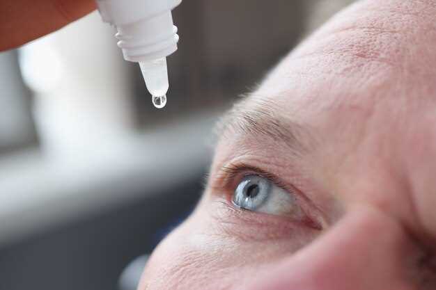 How to Instantly Tell If Your Red Eye Needs Prednisolone Drops–3 Photo Clues You Can Check in 10 Seconds